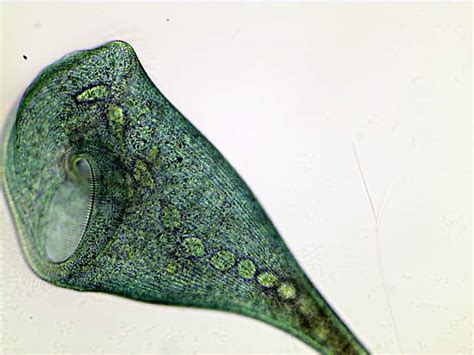  Stentors: A Glimpse into the World of Trumpet-Shaped Microscopic Wonders!